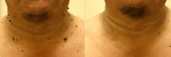 Advanced Cosmetic Procedure Clinic Inverness