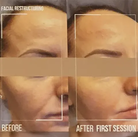 WonderFace Treatment Inverness