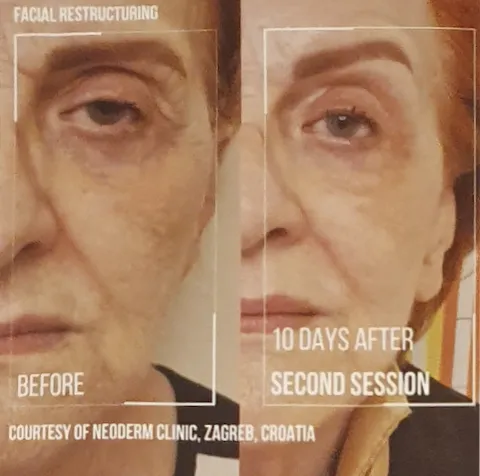 WonderFace Treatment Inverness